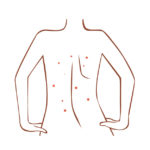 胸元や背中のニキビの原因はなに?どんな対策が必要?