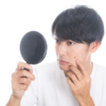 ニキビは治ったのにシミが!必要な対策とは?