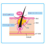 ニキビが固いしこりにならないようにするために気をつけるべきこと